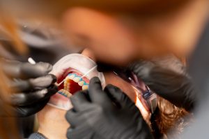 Arco Facial Bioart: Precisão no Registro e Assistência Garantida