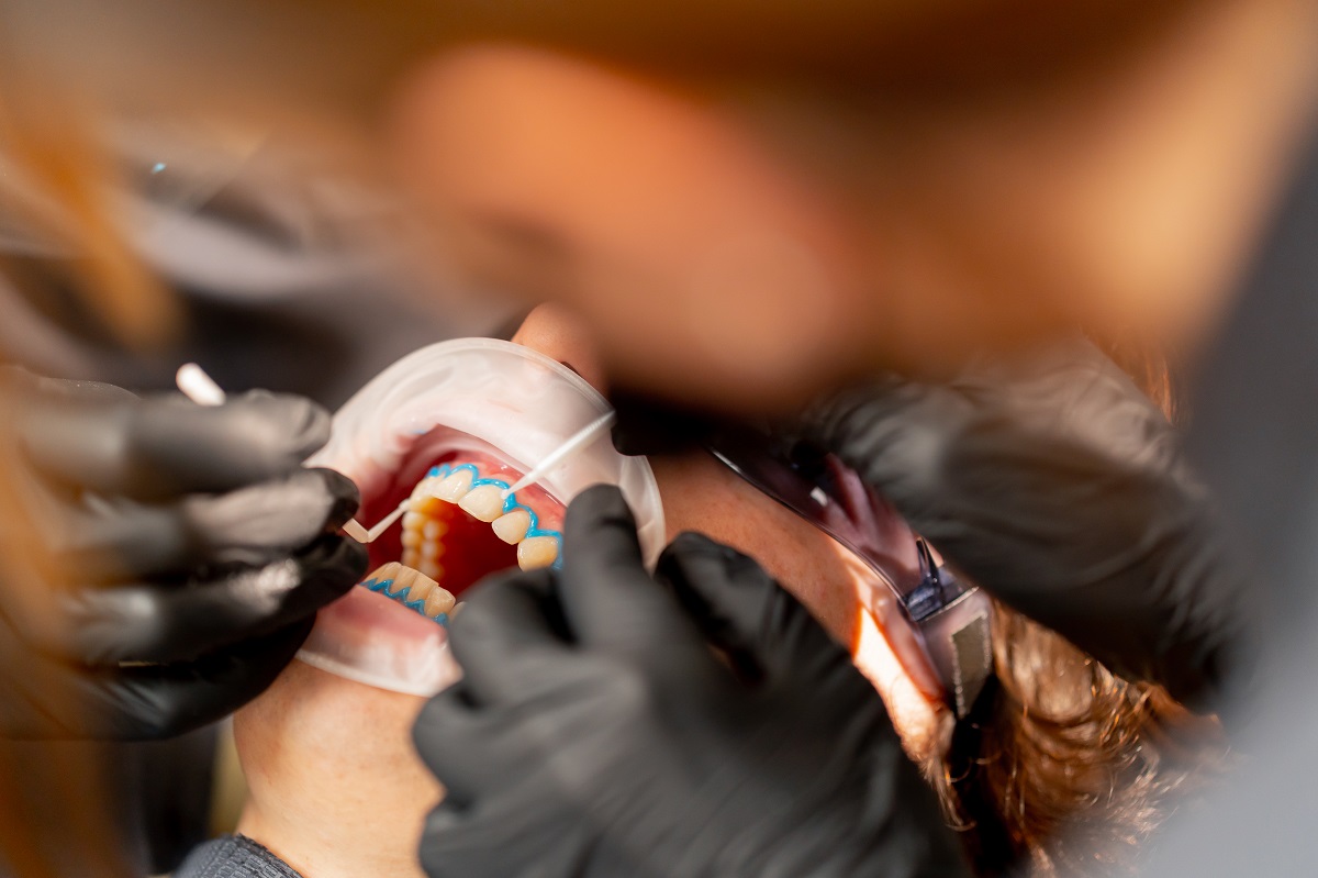 Arco Facial Bioart: Precisão no Registro e Assistência Garantida