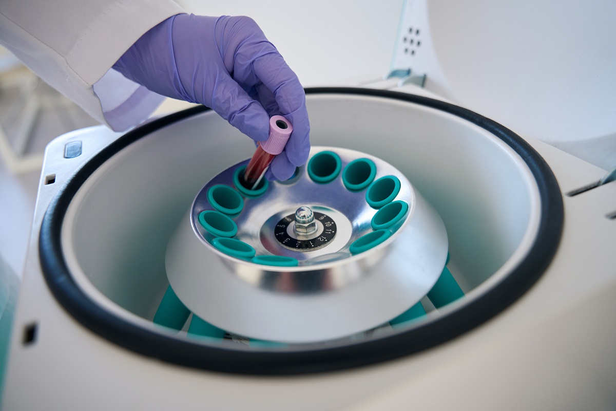Autoclave Bioart: Segurança, Eficiência e Assistência Especializada